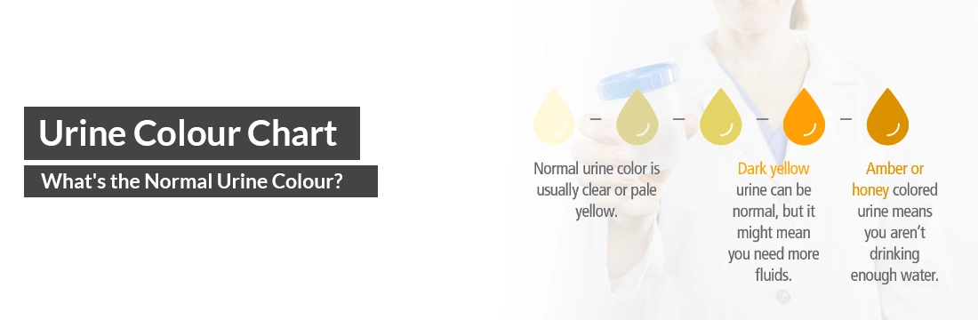 Urine Colour Chart: What's the Normal Urine Colour?